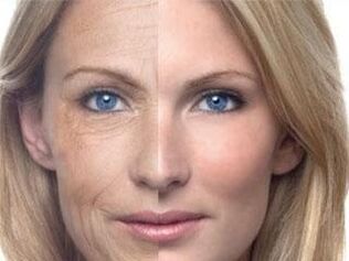 Larruazaleko pigmentazioa